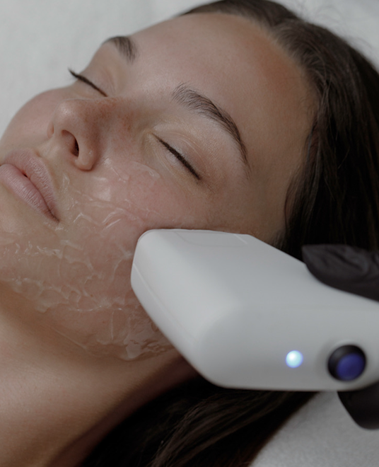 Sofwave Skin Tightening
