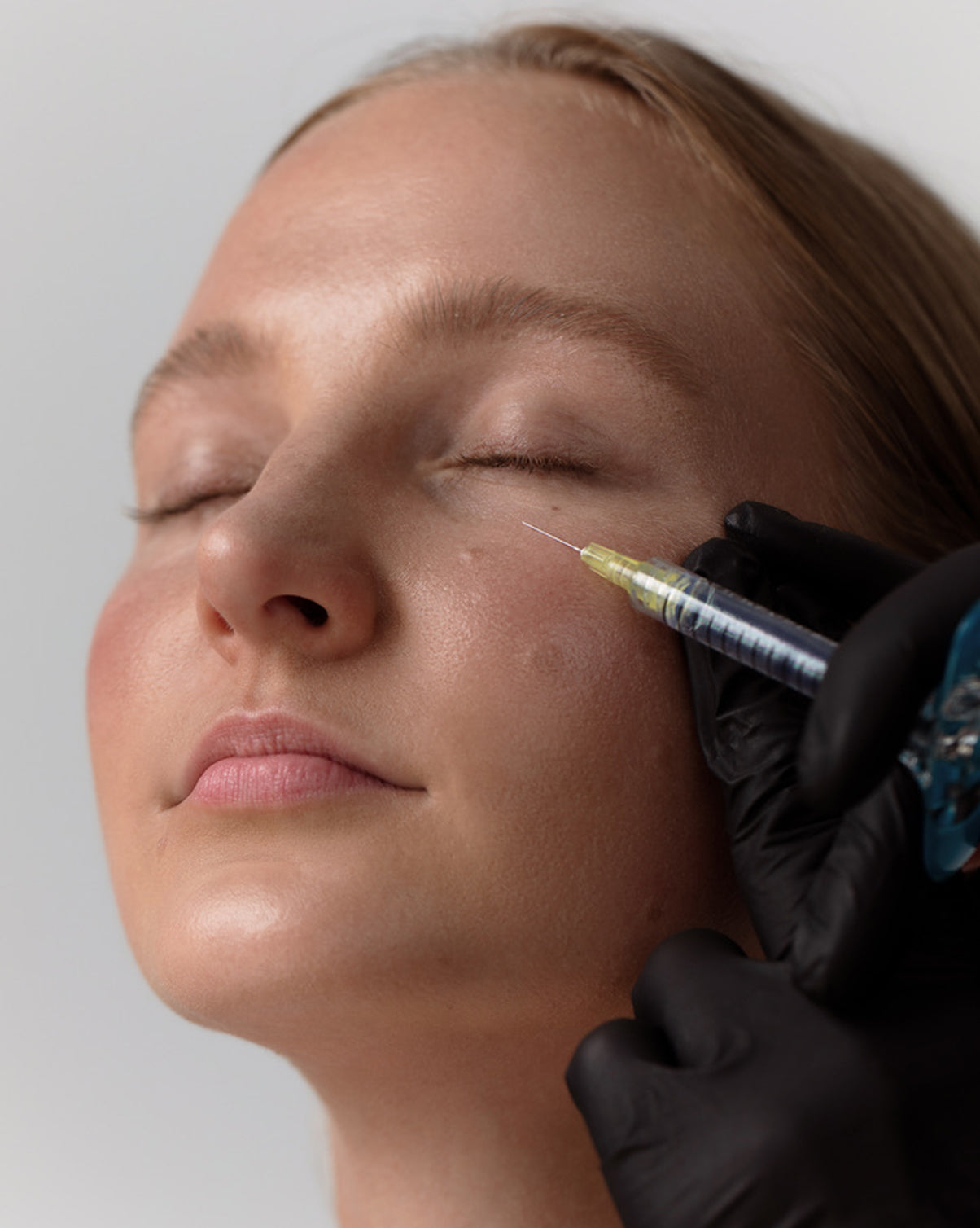 Person receiving a cosmetic injection on their face with a syringe.